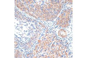 Immunohistochemistry of paraffin-embedded Rat ovary using TIMP2 antibody (ABIN7268483) at dilution of 1:100 (40x lens). (TIMP2 抗体  (AA 100-200))