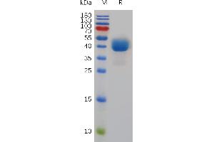 SDS-PAGE (SDS) image for T Cell Immunoreceptor with Ig and ITIM Domains (TIGIT) (AA 28-139) protein (Fc Tag) (ABIN7491059)