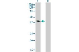 Western Blot analysis of CA12 expression in transfected 293T cell line by CA12 monoclonal antibody (M01), clone 1D4. (CA12 抗体  (AA 25-124))