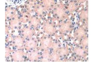 IHC-P analysis of Mouse Kidney Tissue, with DAB staining. (HPSE 抗体  (AA 280-412))