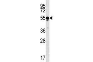 TUBB4Q antibody western blot analysis in Jurkat lysate. (TUBB4Q 抗体  (AA 64-93))