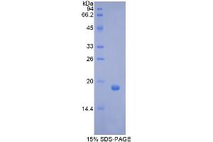 SDS-PAGE analysis of Pig GCSF Protein. (G-CSF 蛋白)