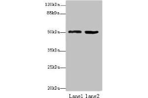 Western blot All lanes: ZBTB32 antibody at 4 μg/mL Lane 1: Mouse brain tissue Lane 2: Jurkat whole cell lysate Secondary Goat polyclonal to rabbit IgG at 1/10000 dilution Predicted band size: 53 kDa Observed band size: 53 kDa (ZBTB32 抗体  (AA 1-294))