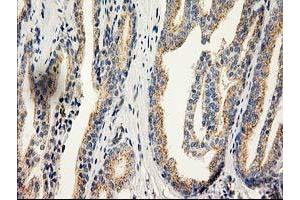 Image no. 3 for anti-Catalase (CAT) antibody (ABIN1497109) (Catalase 抗体)