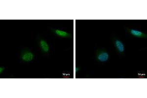 ICC/IF Image MCAK antibody [N1N3] detects MCAK protein at nucleus by immunofluorescent analysis.