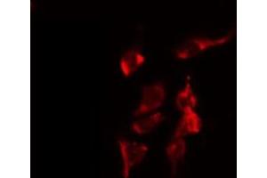 ABIN6274740 staining COLO205 by IF/ICC. (MRPL40 抗体  (C-Term))