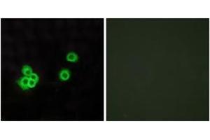 Immunofluorescence analysis of MCF7 cells, using PEA15 Antibody. (PEA15 抗体  (AA 61-110))