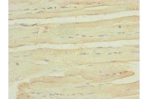 Immunohistochemistry of paraffin-embedded human skeletal muscle tissue using ABIN7174957 at dilution of 1:100 (MYO5B 抗体  (AA 1440-1690))