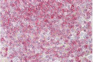 Immunohistochemistry with Spleen tissue at an antibody concentration of 5µg/ml using anti-RIPK3 antibody (AVARP00031_P050) (RIPK3 抗体  (Middle Region))
