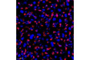 Immunofluorescent analysis of paraffin embedded rat plancta using HOMER3 (ABIN7074257) at dilution of 1: 700