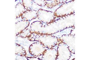 Immunohistochemistry of paraffin-embedded rat kidney using NDRG1 Rabbit mAb (ABIN7268783) at dilution of 1:100 (40x lens). (NDRG1 抗体)