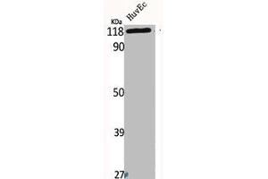 Western Blot analysis of HuvEc cells using Bek Polyclonal Antibody (FGFR2 抗体  (Internal Region))