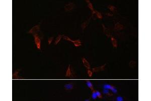 Immunofluorescence analysis of NIH/3T3 cells using PLA2G5 Polyclonal Antibody at dilution of 1:100. (PLA2G5 抗体)