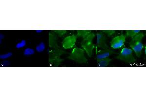 Immunocytochemistry/Immunofluorescence analysis using Mouse Anti-CD74 Monoclonal Antibody, Clone PIN 1. (CD74 抗体  (Atto 594))