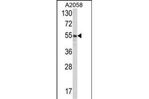 Western blot analysis of PDIA3 Antibody (C-term) (ABIN389464 and ABIN2839529) in  cell line lysates (35 μg/lane). (PDIA3 抗体  (C-Term))
