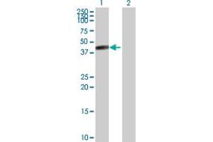 Western Blot analysis of CPB1 expression in transfected 293T cell line by CPB1 MaxPab rabbit polyclonal antibody. (CPB1 抗体  (AA 1-417))