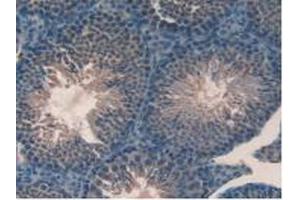 Detection of GPX4 in Mouse Testis Tissue using Polyclonal Antibody to Glutathione Peroxidase 4 (GPX4)