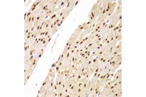 Immunohistochemistry of paraffin-embedded human colon using SUPT20H antibody (ABIN5975125) at dilution of 1/100 (40x lens). (FAM48A/P38IP 抗体)