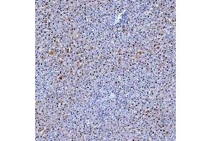 IHC analysis of Thymidylate Synthase/TYMS using anti-Thymidylate Synthase/TYMS antibody (ABIN7599260).