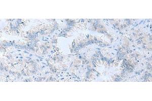 Immunohistochemistry (Paraffin-embedded Sections) (IHC (p)) image for anti-ATPase, H+ Transporting, Lysosomal 42kDa, V1 Subunit C1 (ATP6V1C1) antibody (ABIN7247105)