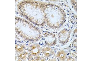 Immunohistochemistry of paraffin-embedded human stomach using CPM antibody (ABIN6128978, ABIN6138956, ABIN6138957 and ABIN6222238) at dilution of 1:100 (40x lens). (CPM 抗体  (AA 204-443))
