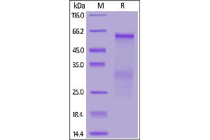 SARS-Coronavirus Nucleocapsid Protein (SARS-CoV N) (Active) protein (His tag)