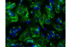 Immunofluorescent staining of SK-N-SH cells. (PRKAR2B 抗体  (pSer114))
