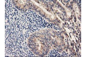 Image no. 1 for anti-Prenyl (Decaprenyl) Diphosphate Synthase, Subunit 2 (PDSS2) antibody (ABIN1500138) (PDSS2 抗体)