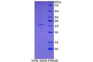 SDS-PAGE analysis of Pig FTH Protein. (Ferritin, Heavy Polypeptide 1 (FTH1) Peptide)