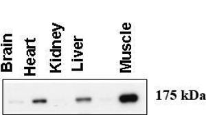 Image no. 1 for anti-Amylo-alpha-1, 6-Glucosidase, 4-alpha-Glucanotransferase (AGL) (AA 1487-1516), (C-Term) antibody (ABIN357688) (AGL 抗体  (C-Term))