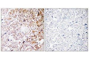 Immunohistochemistry (IHC) image for anti-Coiled-Coil Domain Containing 102B (CCDC102B) (Internal Region) antibody (ABIN1851142) (CCDC102B 抗体  (Internal Region))