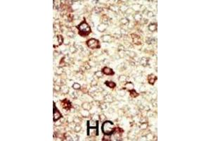 Immunohistochemistry (IHC) image for anti-Fibroblast Growth Factor Receptor 4 (FGFR4) antibody (ABIN2929142) (FGFR4 抗体)