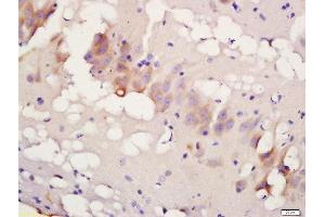 Formalin-fixed and paraffin embedded rat brain labeled with Rabbit Anti-TBK1 (Ser172) Polyclonal Antibody, Unconjugated 1:200 followed by conjugation to the secondary antibody and DAB staining (TBK1 抗体  (pSer172))