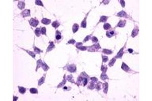 Anti-GRM2 / MGLUR2 antibody immunocytochemistry (ICC) staining of untransfected HEK293 human embryonic kidney cells. (GRM2 抗体  (N-Term))