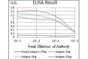Black line: Control Antigen (100 ng), Purple line: Antigen(10 ng), Blue line: Antigen (50 ng), Red line: Antigen (100 ng), (PIK3R1 抗体  (AA 159-388))