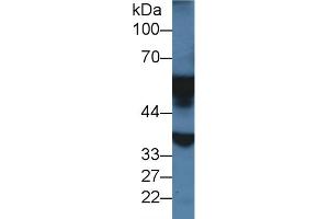 Detection of MAOA in Rat Liver lysate using Polyclonal Antibody to Monoamine Oxidase A (MAOA)