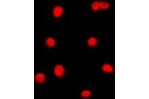 Immunofluorescent analysis of C/EBP gamma staining in Jurkat cells. (CEBPG 抗体)