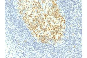 Formalin-fixed, paraffin-embedded human Tonsil stained with MCM7 Mouse Monoclonal Antibody (MCM7/1467). (MCM7 抗体  (AA 195-319))