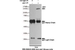Immunoprecipitation analysis of Hela cell lysates using Jak1 mouse mAb. (JAK1 抗体)