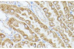 Immunohistochemistry (Paraffin-embedded Sections) (IHC (p)) image for anti-Acetyl-CoA Acetyltransferase 2 (ACAT2) antibody (ABIN7263895)