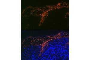 Immunofluorescence (IF) image for anti-TP53 Apoptosis Effector (PERP) antibody (ABIN7270861)