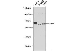 Western blot analysis of extracts of various cell lines using RTKN Polyclonal Antibody at dilution of 1:1000. (Rhotekin 抗体)