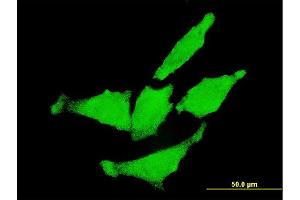 Immunofluorescence (IF) image for anti-Receptor tyrosine-protein kinase erbB-2 (ErbB2/Her2) (AA 22-121) antibody (ABIN515370)