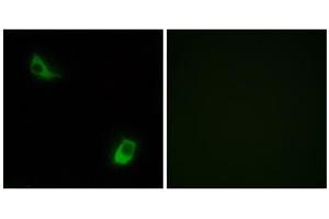 Immunofluorescence analysis of LOVO cells, using FPRL2 antibody. (FPR3 抗体  (C-Term))