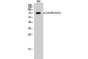 Western Blotting (WB) image for anti-Cell Division Cycle 25 Homolog B (S. Pombe) (CDC25B) (pSer323) antibody (ABIN3181956) (CDC25B 抗体  (pSer323))