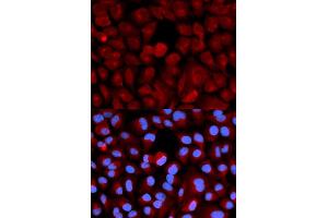 Immunofluorescence (IF) image for anti-Transcription Elongation Factor B (SIII), Polypeptide 2 (18kDa, Elongin B) (TCEB2) antibody (ABIN1876550) (TCEB2 抗体)
