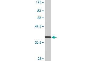 Western Blot detection against Immunogen (38. (JNK 抗体  (AA 318-427))