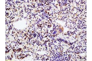 Immunohistochemistry (Paraffin-embedded Sections) (IHC (p)) image for anti-Interleukin 17C (IL17C) (AA 101-197) antibody (ABIN747983)