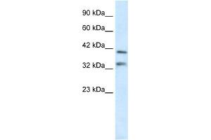 WB Suggested Anti-GSH2 Antibody Titration:  0. (GSX2 抗体  (N-Term))