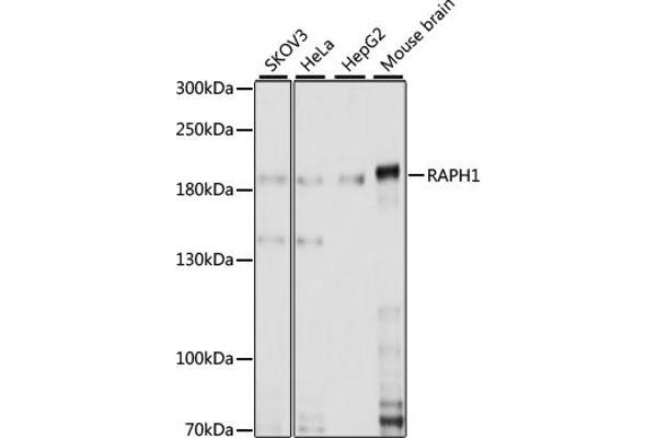 RAPH1 抗体  (AA 1-240)